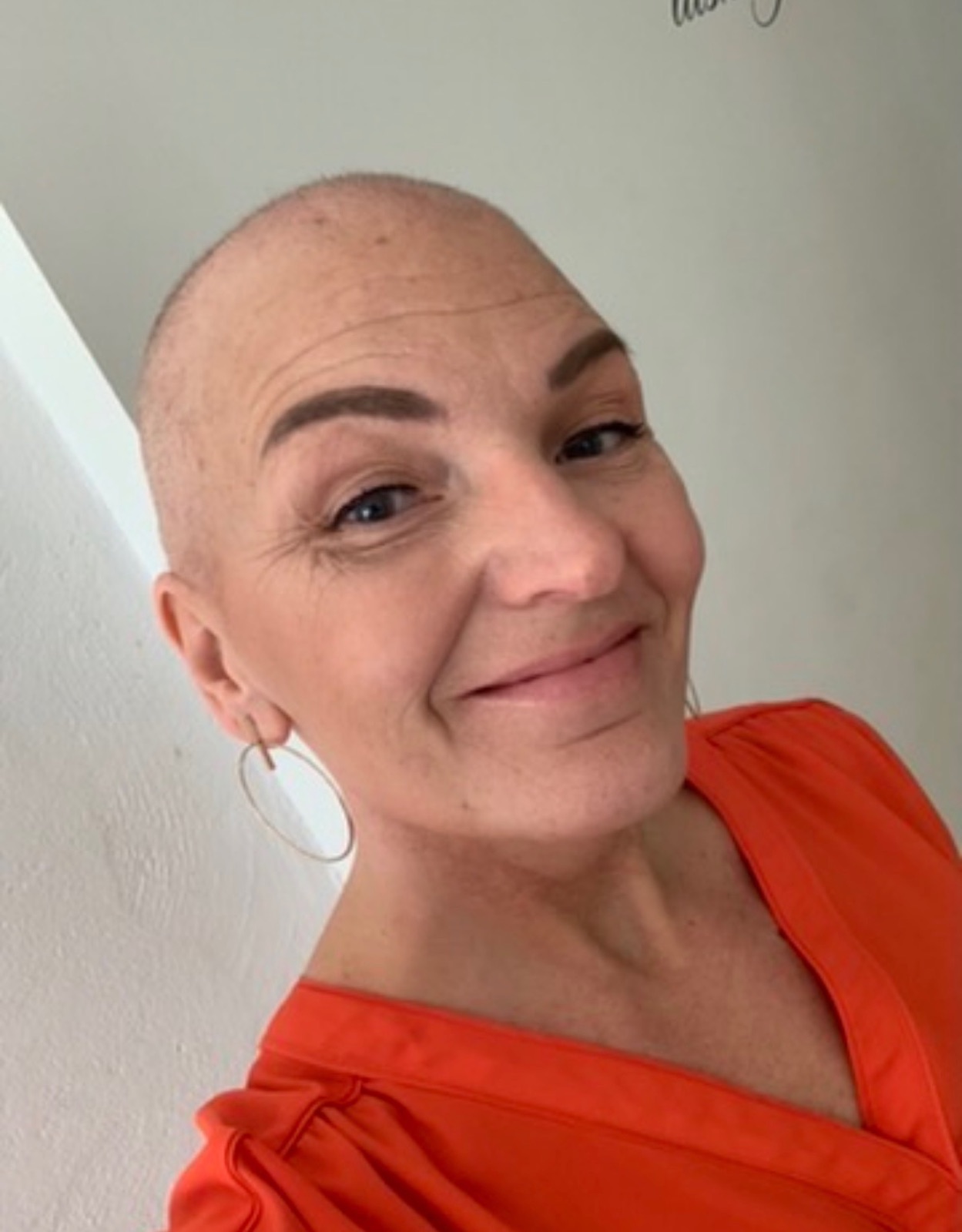 Camilla Gasslander under sin egen bröstcancerbehandling